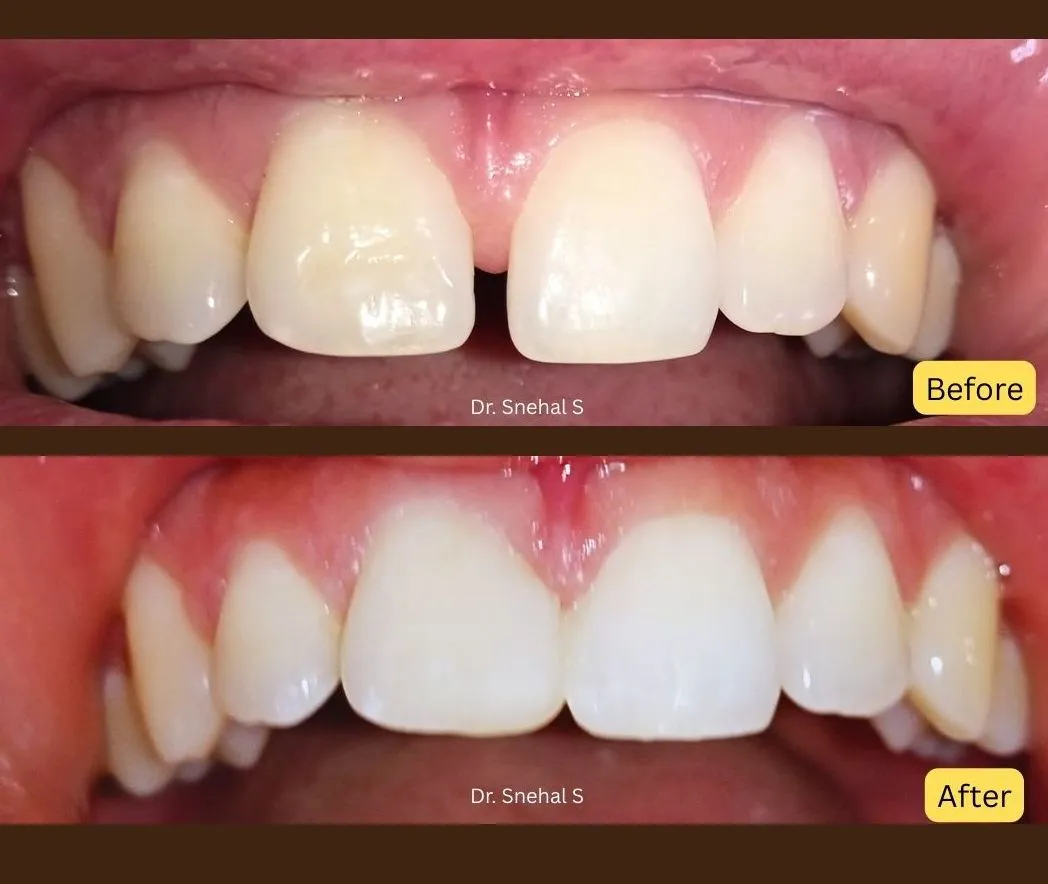 Dental Check-Up
